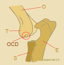 Osteochondrose dissecans des Ellbogens